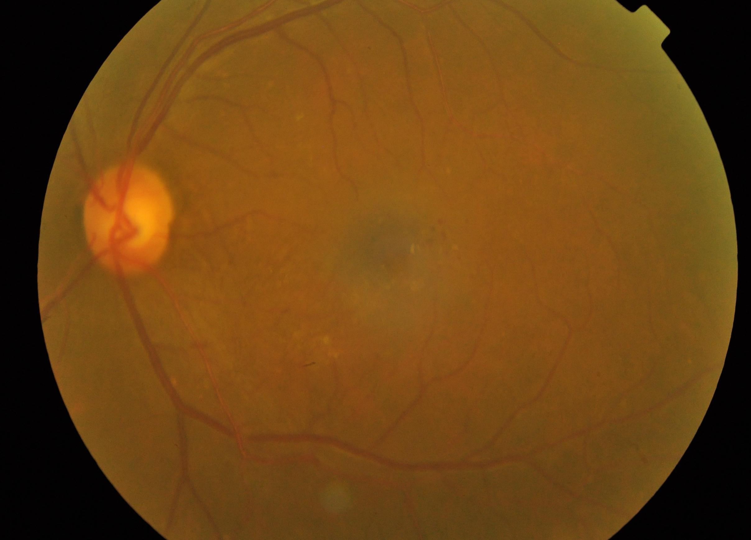 fundus image